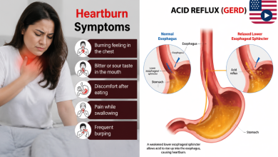heartburn symptoms