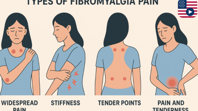what is fibromyalgia