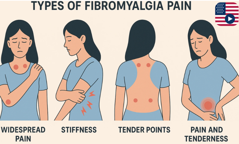 what is fibromyalgia